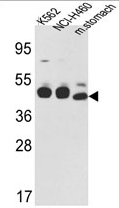 AP17266PU-N - Cytokeratin 18