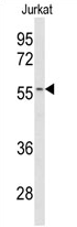 AP17267PU-N - CYP2C19