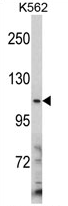 H00001653-M02 - DDX1