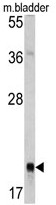 AP17693PU-N - RAB13
