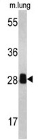 AP17686PU-N - PSME2 / REG-beta