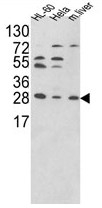 AP17685PU-N - PSME2 / REG-beta