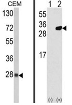 AP17665PU-N - Peroxiredoxin-6 / PRDX6