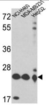 AP17663PU-N - Peroxiredoxin-3 / PRDX3