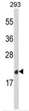 AP17661PU-N - Peroxiredoxin-2 / PRDX2