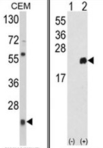 AP17660PU-N - Peroxiredoxin-1 / PRDX1