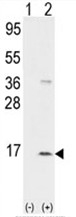 AP17656PU-N - NAP2 / PPBP / CXCL7