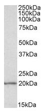 AP09604PU-N - EIF5A1