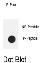 AP17638PU-N - CD130 / IL6ST