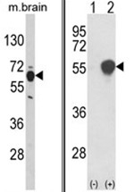 AP17635PU-N - PHGDH