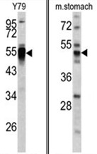 AP17629PU-N - PDIA6 / P5