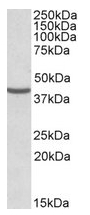 AP09598PU-N - NUDC