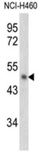 AP17618PU-N - SERPINB2 / PAI2