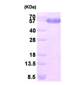 AR09404PU-L - Dihydrolipoyl dehydrogenase