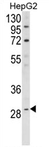 H00001733-M01 - DIO1