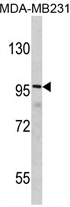 AP17283PU-N - DLGAP1 / SAPAP1