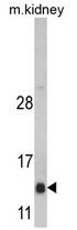 AP17286PU-N - DNAJC19 / TIM14
