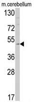 AP17303PU-N - Endothelin B receptor