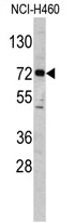 AP17322PU-N - ELP2 / STATIP1