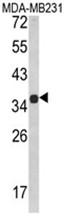 AP17568PU-N - MSRB2