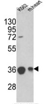 AP17557PU-N - MDH2