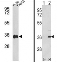 AP17556PU-N - MDH1