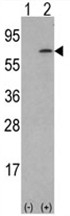 AP17554PU-N - M-CSF / CSF-1