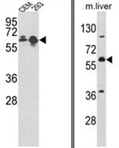 AP17553PU-N - MCCC2
