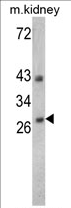AP17329PU-N - Endonuclease G