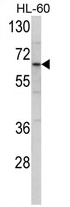 AP17338PU-N - Clathrin interactor 1