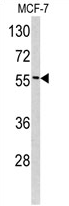 AP17340PU-N - Epsin-3