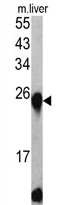 AP17351PU-N - ETHE1 / HSCO
