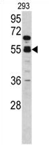 AP17353PU-N - Coagulation factor X (F10)