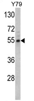 AP17358PU-N - Fascin