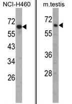 AP17360PU-N - Fascin-3