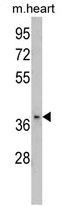 AP17363PU-N - FBP2