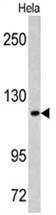 AP17543PU-N - Mastermind-like protein 3