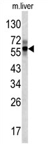 AP17373PU-N - Fibrinogen beta chain