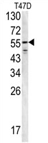AP17374PU-N - Fibrinogen beta chain