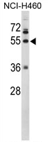 AP17375PU-N - Fibrinogen gamma chain