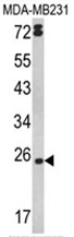 AP17540PU-N - TNF-beta / Lymphotoxin-alpha