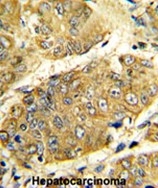AP17540PU-N - TNF-beta / Lymphotoxin-alpha
