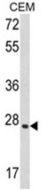 AP17537PU-N - Leukemia inhibitory factor