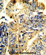 AP17537PU-N - Leukemia inhibitory factor