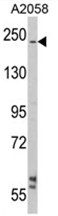 AP17535PU-N - Laminin beta-2