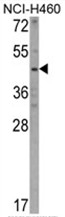 AP17533PU-N - Kynureninase