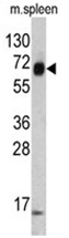 AP17531PU-N - Cytokeratin 4