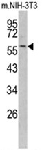 AP17528PU-N - Cytokeratin 14