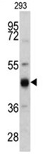 AP17527PU-N - Cytokeratin 13