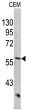 AP17525PU-N - Cytokeratin 10
